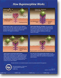 How Buprenorphine Works